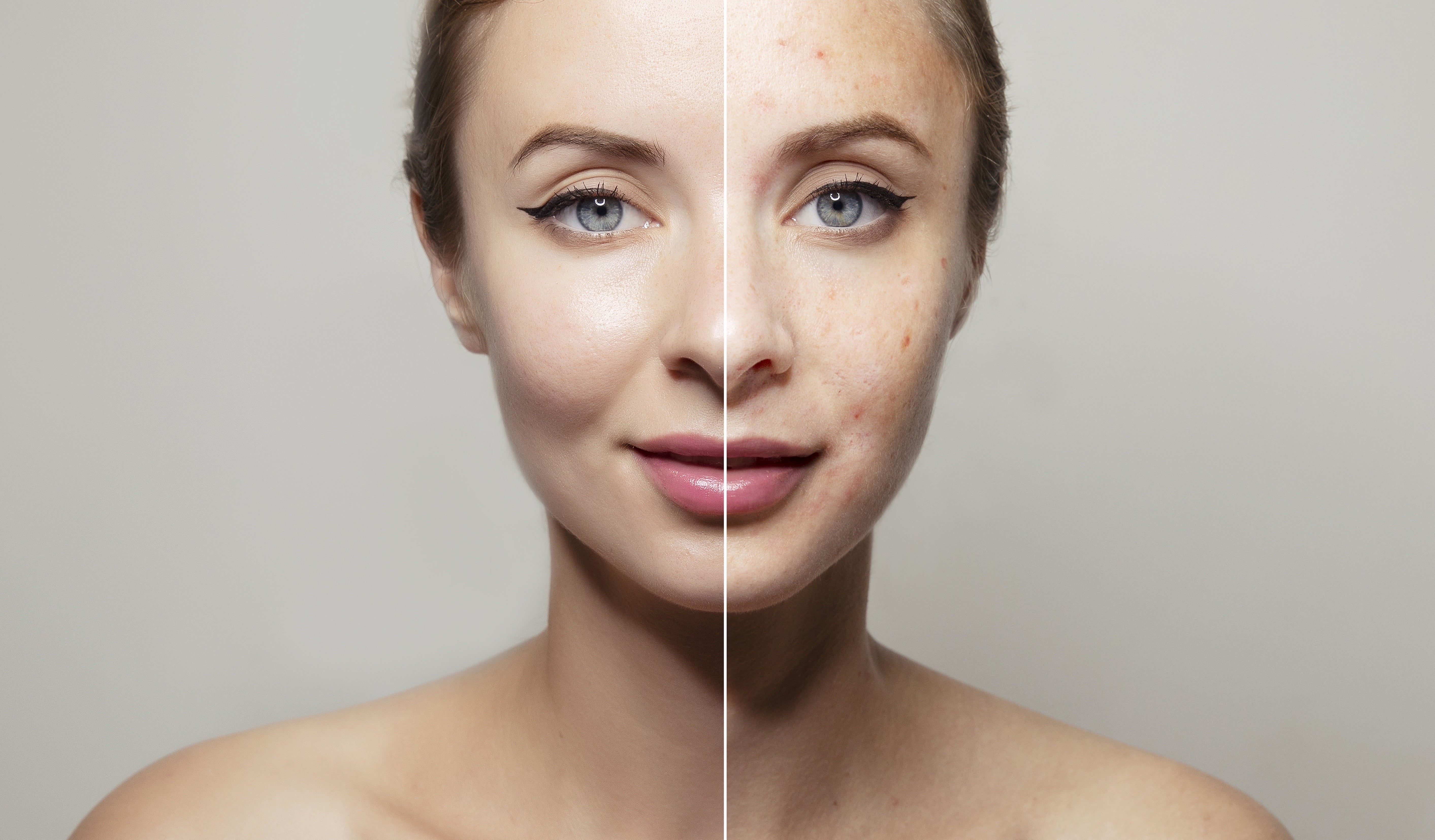 Different skin types: How to determine your skin type and why it is im ...