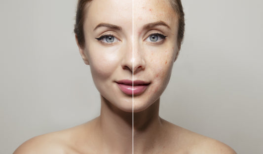 Different skin types: How to determine your skin type and why it is important to know it